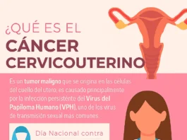 CÁNCER CERVICOUTERINO: URGENCIA Y DESIGUALDAD EN MÉXICO